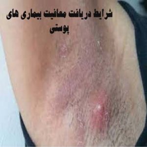 مدارک لازم معافیت پزشکی